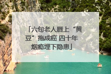 六旬老人唇上“黄豆”拖成癌 四十年烟瘾埋下隐患
