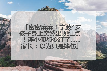 密密麻麻！宁波4岁孩子身上突然出现红点！连小便都变红了……家长：以为只是摔伤